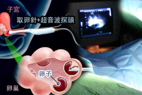 武汉试管供卵补贴 2023年武汉哪家公立医院做三代试管